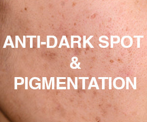 Anti-dark Spot & Pigmentation