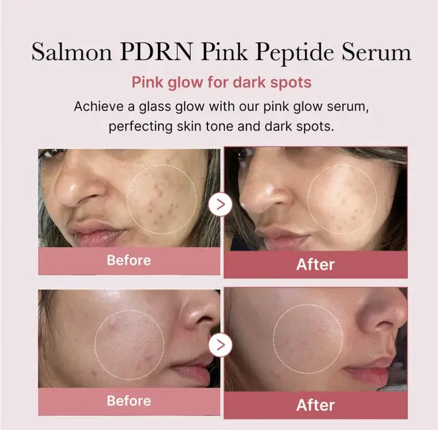 PDRN Pink Peptide Serum
