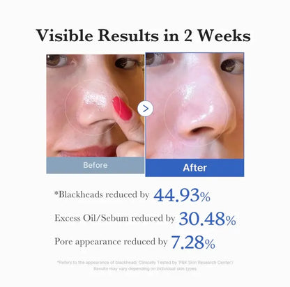 Zero Pore Pad 2.0